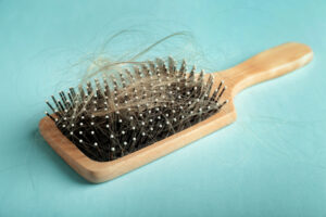 Perdita dei capelli nelle donne